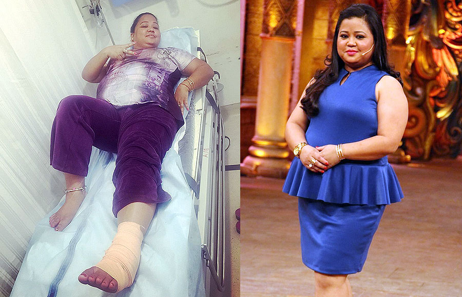  Bharti Singh- Bharti injured her leg as she slipped on the staircase and was hospitalized. She tore a ligament.